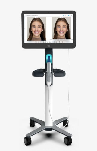 An iTero Scanner showing the before and after images of a young woman's alignment treatment.